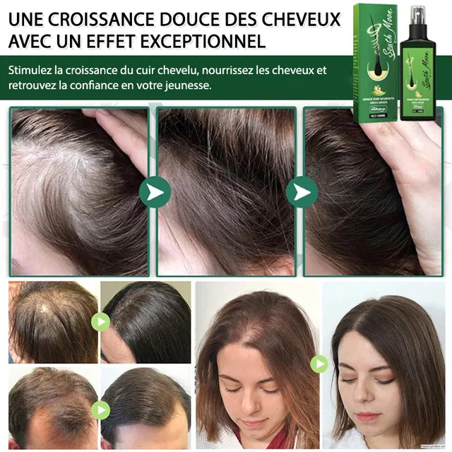 Soin Repousse Cheveux au Gingembre