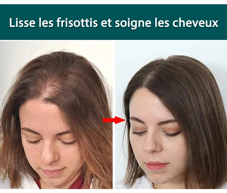 Soin Repousse Cheveux au Gingembre