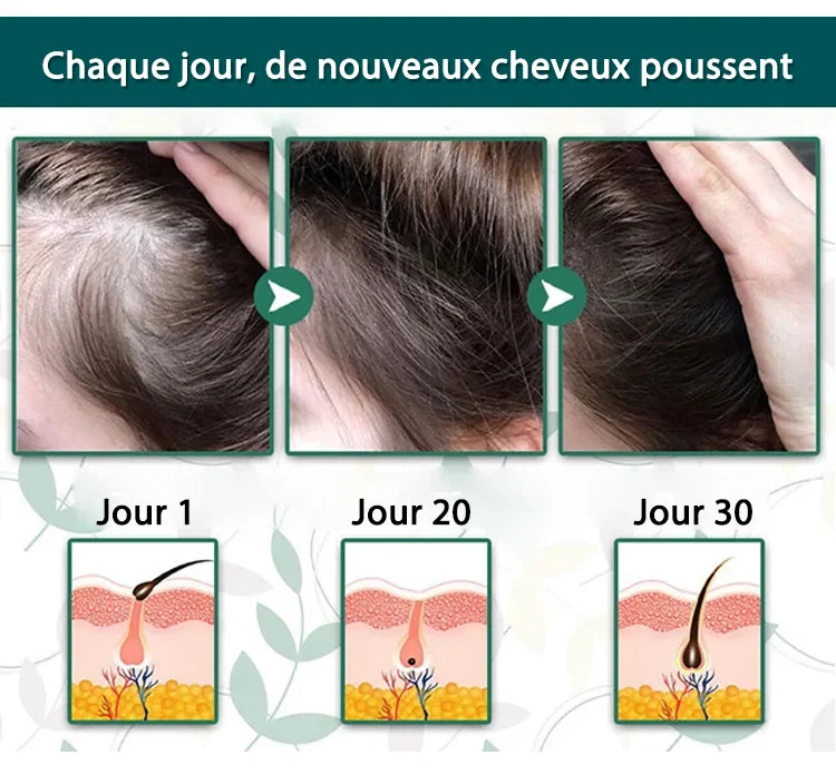 Soin Repousse Cheveux au Gingembre